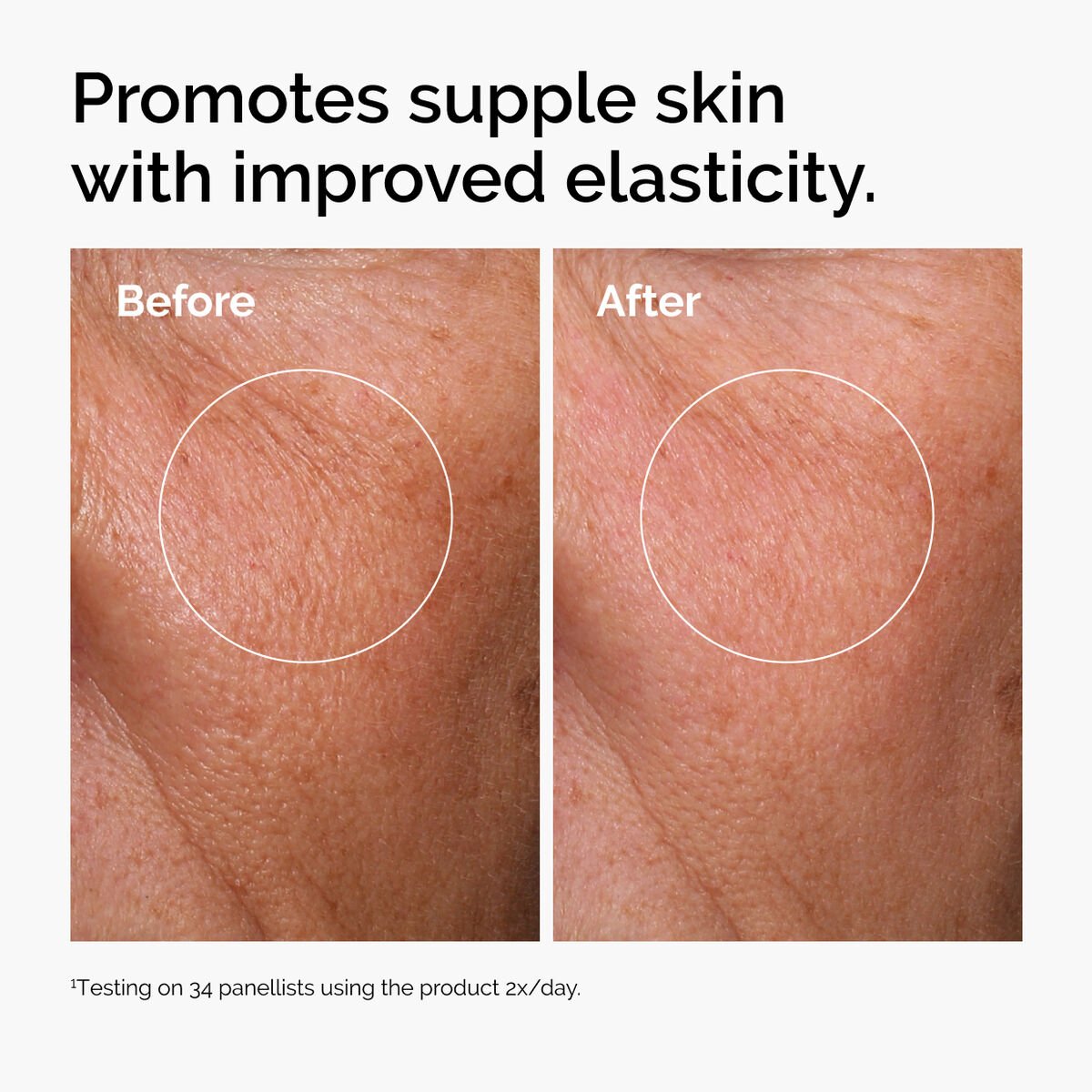 The Ordinary Hyaluronic Acid 2% + Vitamin B5 Hydrating Serum β Plumps, Soothes & Repairs Dry/Dehydrated Skin (30ml)
