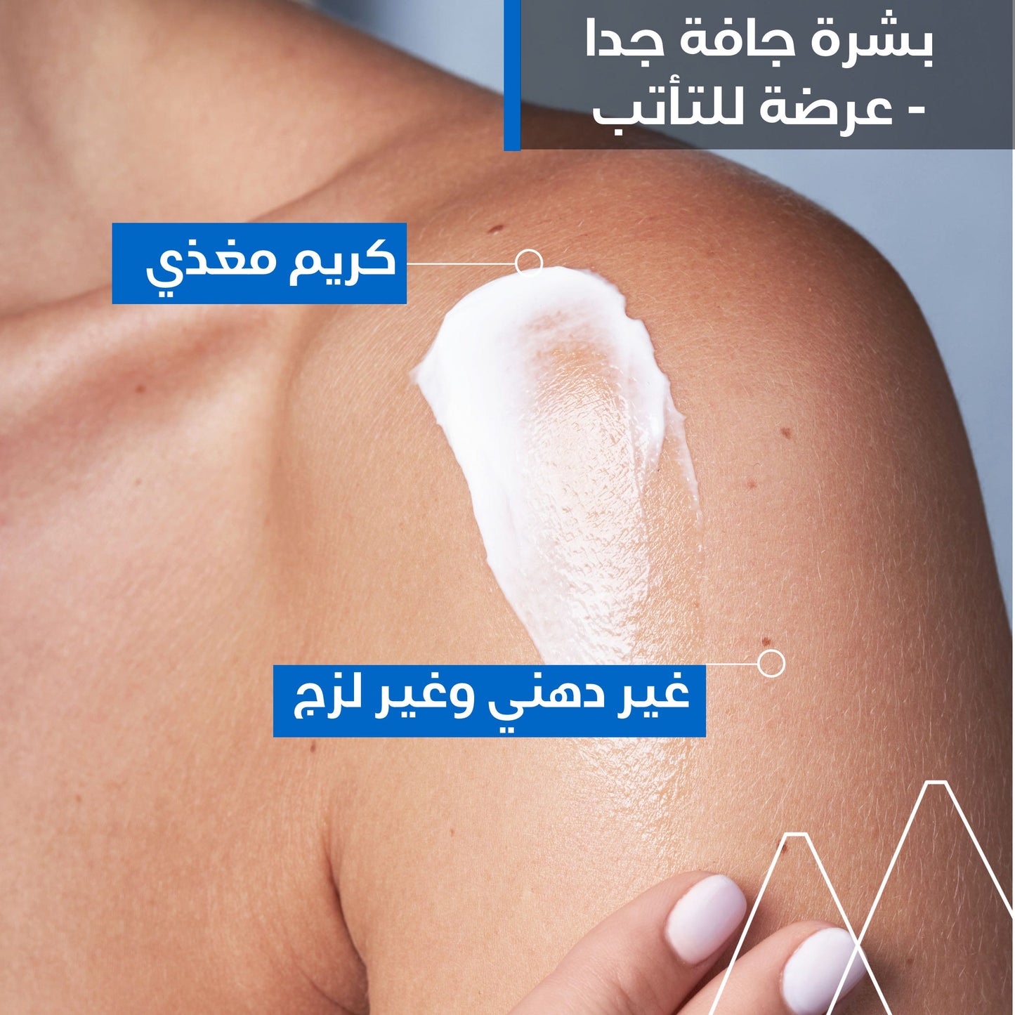 كريم يورياج زيموز المضاد للتهيج والحكة المعيد للدهون 200 مل