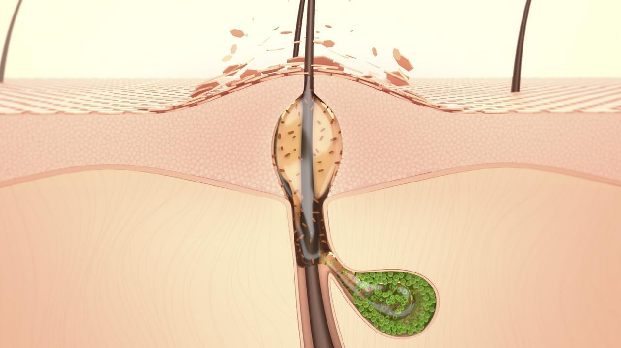 Bioderma Sebium Kerato+ Gel Cream 30ml