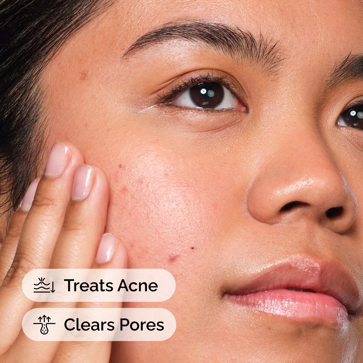 The Ordinary Salicylic Acid 2% Face Serum – BHA Exfoliant for Acne-Prone Skin, Blackheads & Visible Pores (30ml)