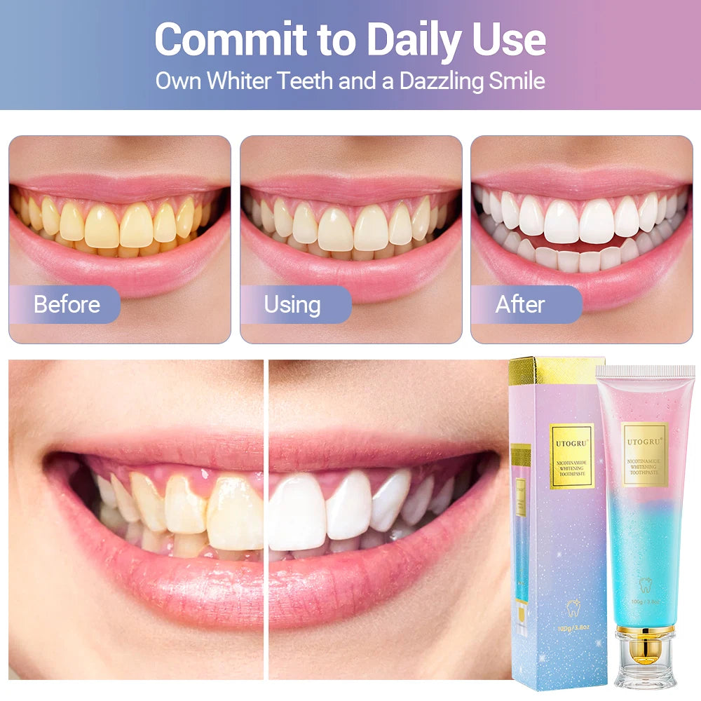 Whitening Toothpaste Nicotinamide Dazzling Toothpaste Remove Plaque Stains Teeth Oral Hygiene Clean Fresh Breath Teeth Care 100g