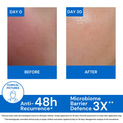 Uriage Xemose Anti-Itch Soothing Oil Balm 500Ml